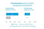 Парадонтален гел Pocket-X